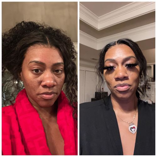 Customer photo review of EvenSkyn® Lumo: Premium Anti-Aging & Skin Tightening Handset