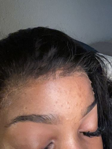 Customer photo review of Melting! Body Wave Swiss HD Undetectable Lace 13x4 Lace Frontal Wig