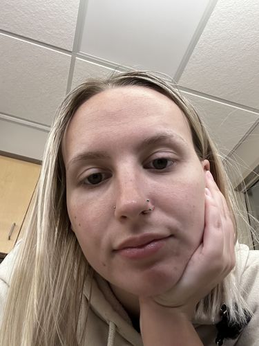 Customer photo review of Double Gem Internally Threaded Horseshoe 18g