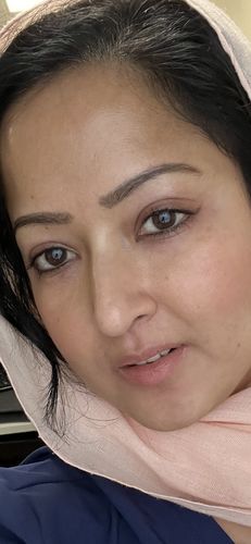 Customer photo review of EvenSkyn® Lumo: Premium Anti-Aging & Skin Tightening Handset