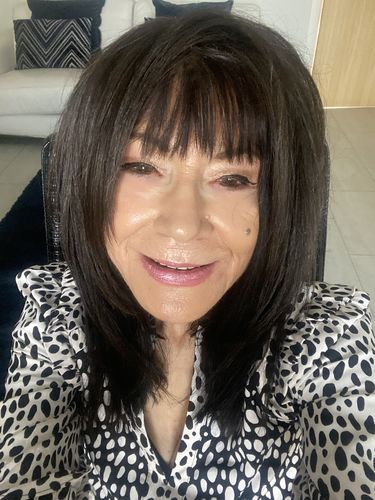 Customer photo review of EvenSkyn® Lumo: Premium Anti-Aging & Skin Tightening Handset