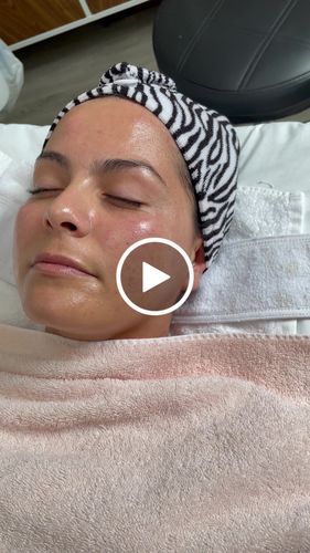 Customer video review of Multi Vitamin C Serum