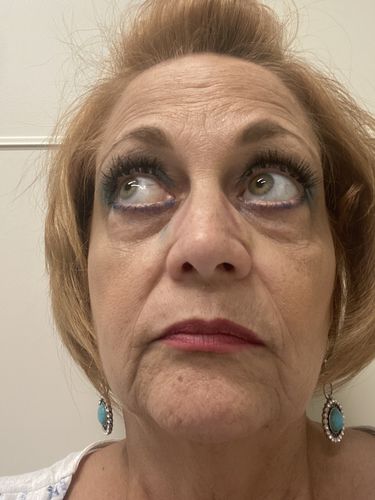 Customer photo review of WINGS DIY Cluster Lashes COMBO KIT mix(10-16mm)