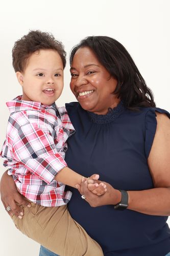 Customer photo review of EvenSkyn® Lumo: Premium Anti-Aging & Skin Tightening Handset