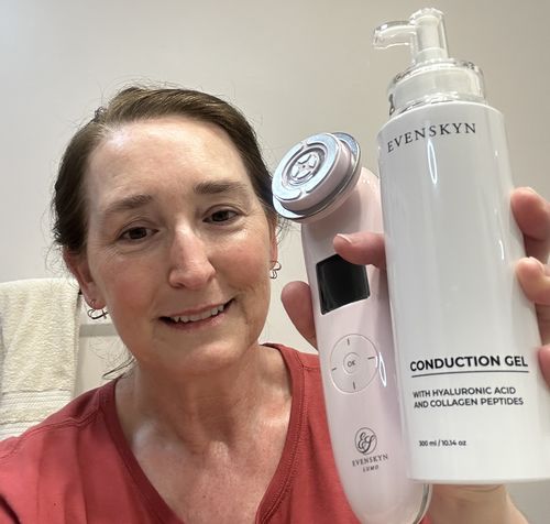 Customer photo review of EvenSkyn® Lumo: Premium Anti-Aging & Skin Tightening Handset