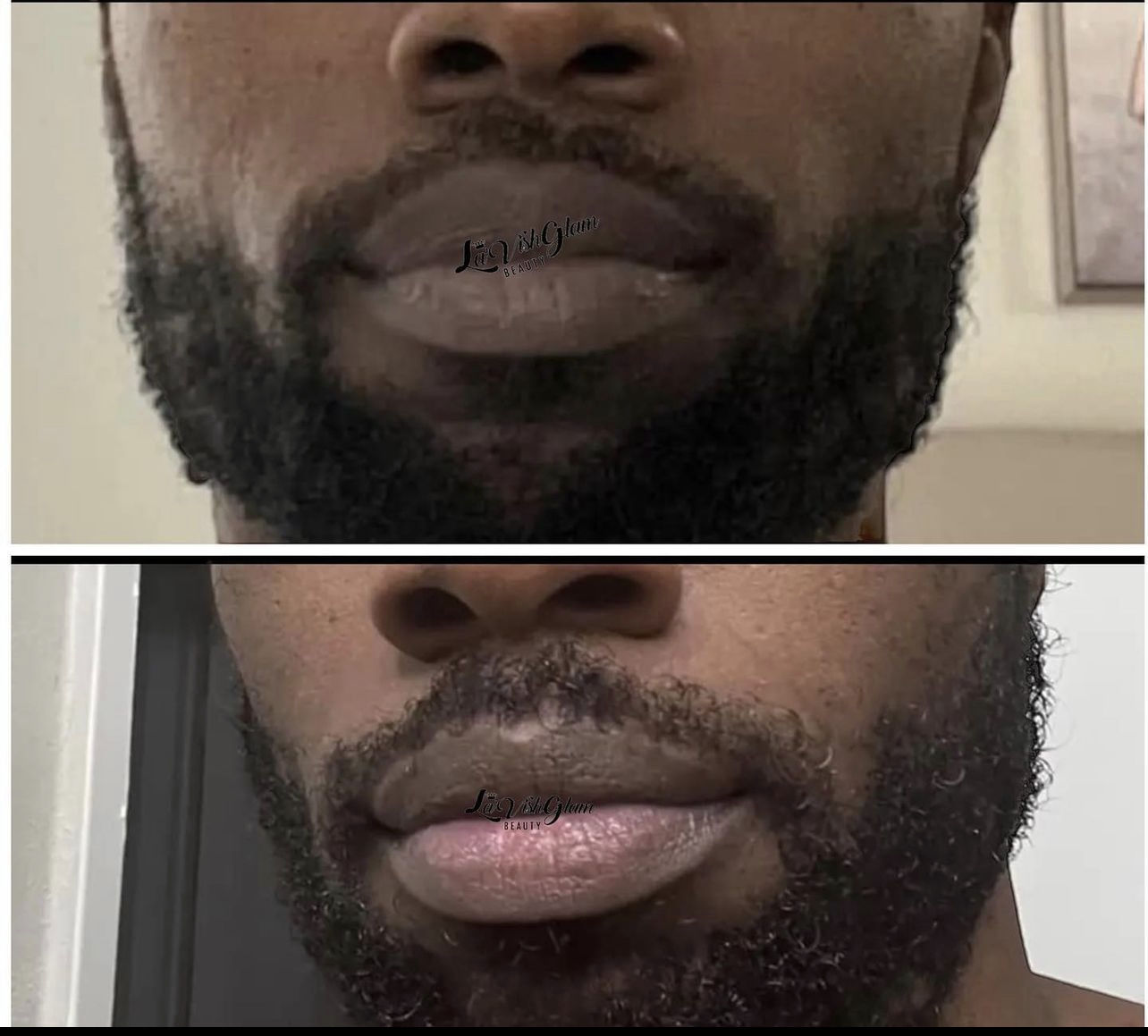 Customer photo review of Pink Lip Kit