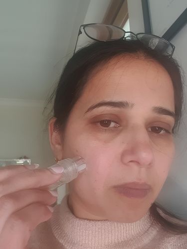 Customer photo review of Hydra Roller 64 Pin 0.25mm Derma Rolling Tool