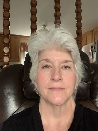 Customer photo review of EvenSkyn® Lumo: Premium Anti-Aging & Skin Tightening Handset