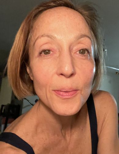 Customer photo review of EvenSkyn® Lumo: Premium Anti-Aging & Skin Tightening Handset