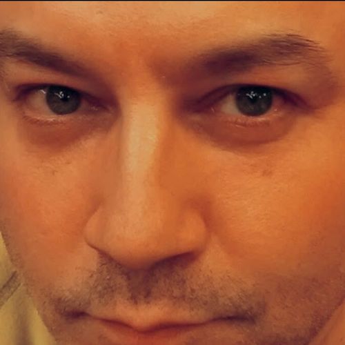 Customer photo review of EvenSkyn® Lumo: Premium Anti-Aging & Skin Tightening Handset