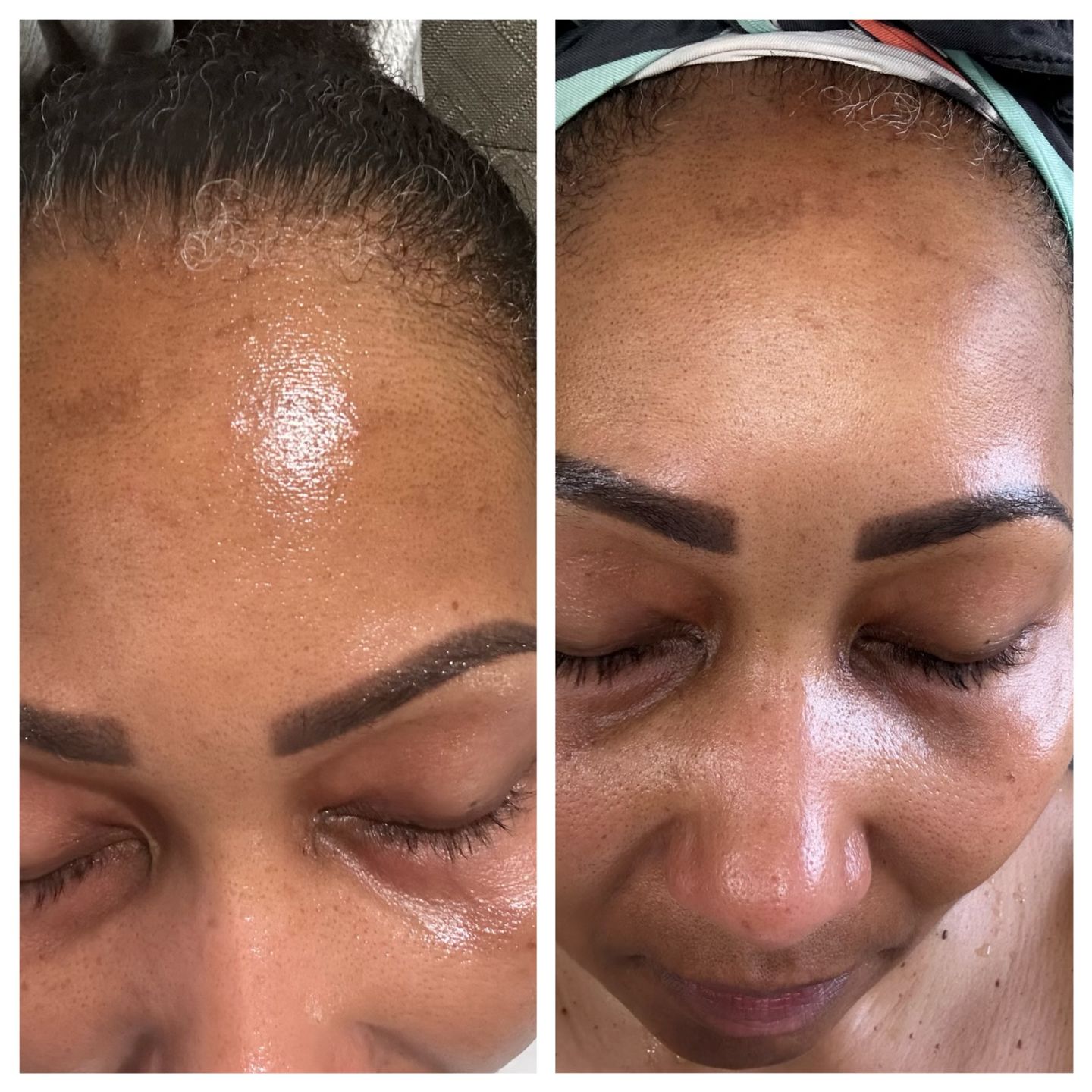 Customer photo review of The Ultimate Body Care Set