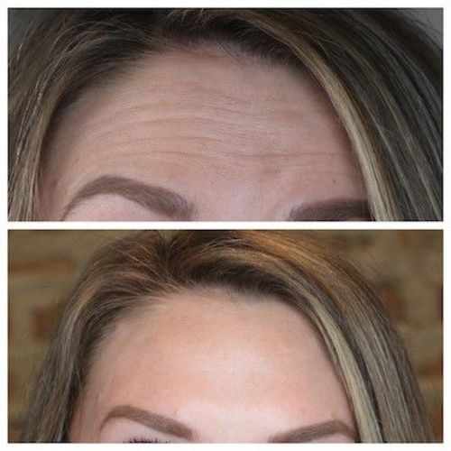 Customer photo review of Multi Purpose Wrinkle Balm Stick