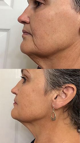 Customer photo review of Multi Purpose Wrinkle Balm Stick