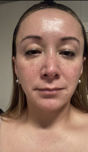 Customer photo review of BEAUTY BOX SERUMS FACIALES CON CÉLULAS MADRE DÍA + NOCHE + CUELLO Y ESCOTE