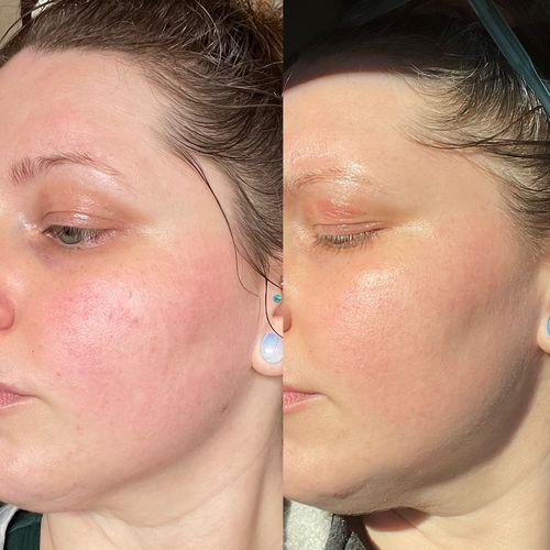 Customer photo review of Gut Maintain - 2 Months Supply