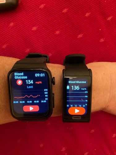 Customer photo review of High-End ECG and Blood Sugar Monitoring Sports Smartwatch