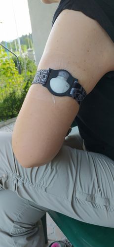 Customer photo review of Guardian Enlite Sensor Adjustable Armband in a Tin Box with 5 stickers - Dia-Style Special Edition PRINTS