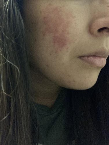 Customer photo review of Emulsión Recuperadora