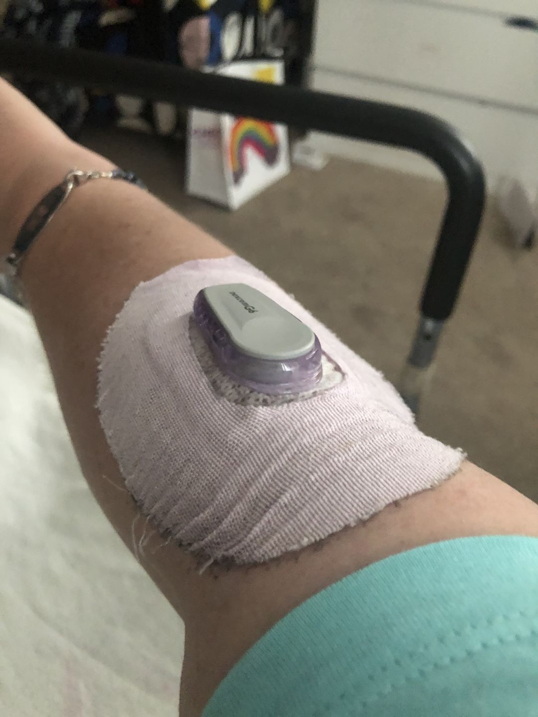 Customer photo review of Skin Grip Original - Omnipod Adhesive Patches