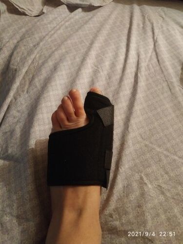 Customer photo review of ZehRelax®️ - Ballenzeh Bandage beidseitig