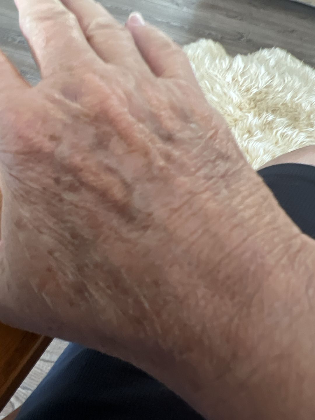 Customer photo review of Moringa Seed Oil - 12mL