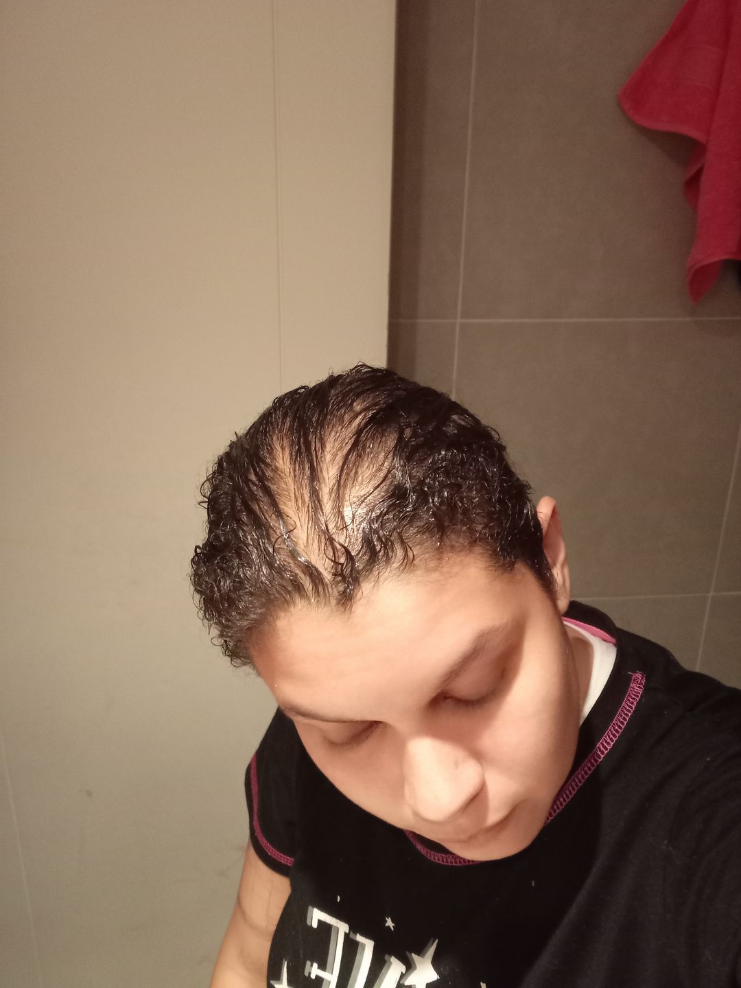 Customer photo review of Tónico anticaída + shampoo anticaída en barra