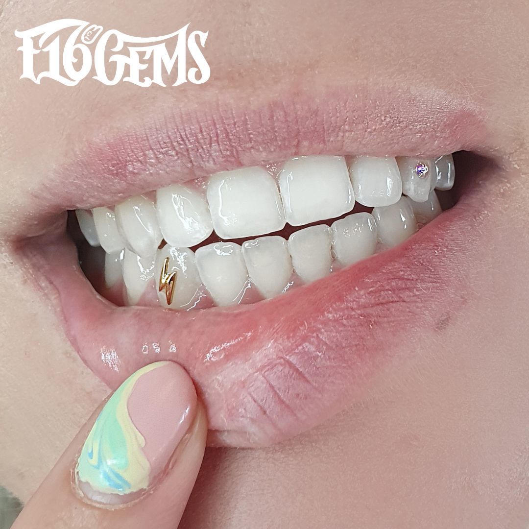 Customer photo review of Bolt 22-karat gold