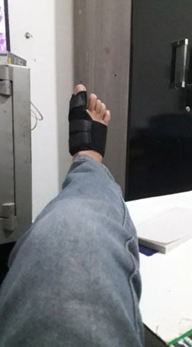 Customer photo review of ZehRelax®️ - Ballenzeh Bandage beidseitig