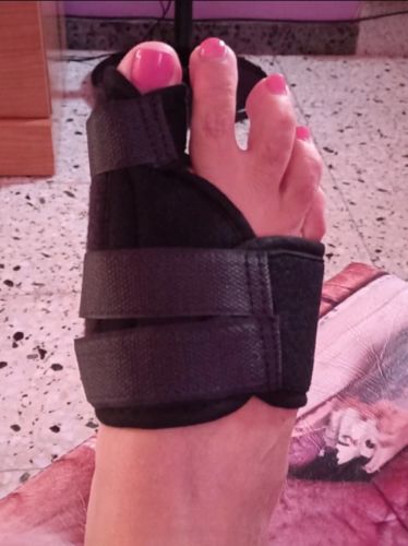 Customer photo review of ZehRelax®️ - Ballenzeh Bandage beidseitig