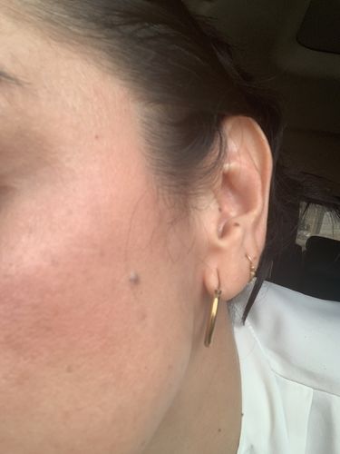 Customer photo review of HYDRO BOOSTER CREMA FACIAL CON 48 HORAS DE HIDRATACIÓN
