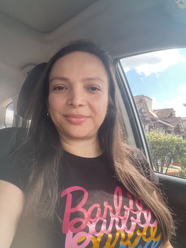 Customer photo review of KIT SUEROS FACIALES DÍA Y NOCHE CON CÉLULAS MADRE, COLÁGENO Y ÁCIDO HIALURÓNICO.