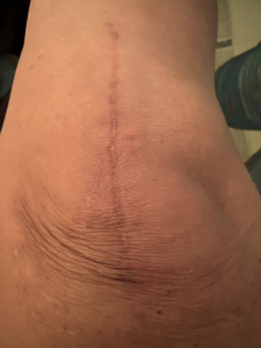 Customer photo review of Combat Ready Ointment - Big Tin