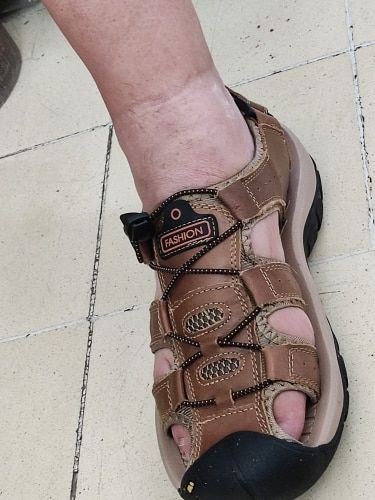 Customer photo review of Zavani Orthosandals - Summer Ortho Sandals in genuine leather