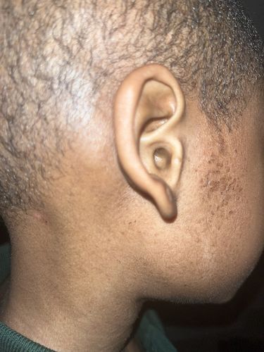 Customer photo review of Body Butter ( Eczema )