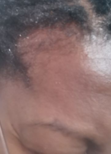 Customer photo review of Hair Growth Potion