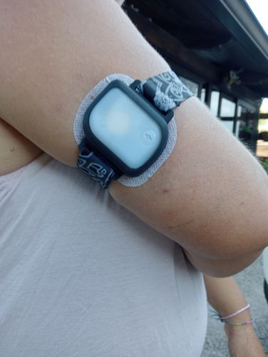 Customer photo review of GlucoMen Day Insulin Patch Pump Adjustable Armband + Tin Box with 3 stickers - Dia-Style Special Edition