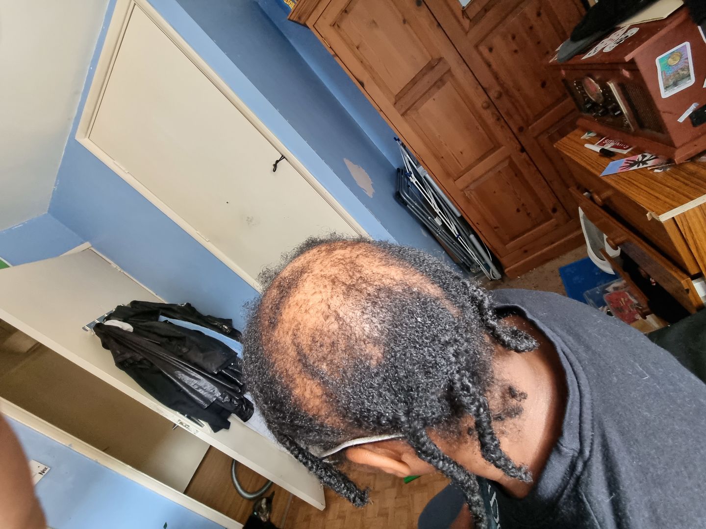 Customer photo review of Hair Recovery Bundle