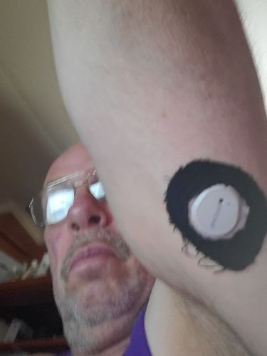 Customer photo review of Skin Grip Original - Dexcom G7 Adhesive Patches (With Hole)