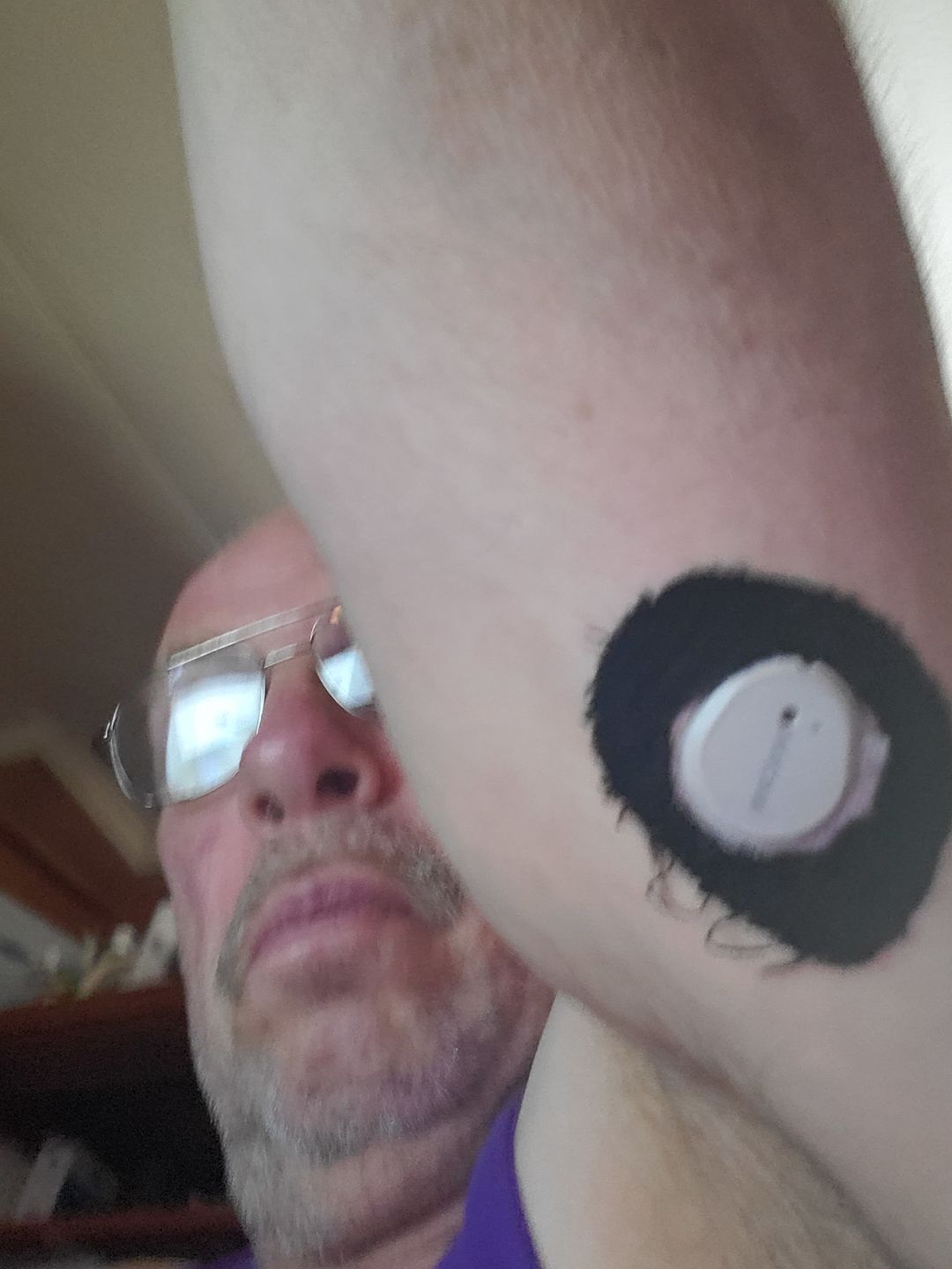 Customer photo review of Skin Grip Original - Dexcom G7 Adhesive Patches (With Hole)
