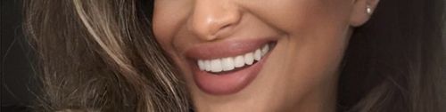 Customer photo review of Teeth-Veneer 2.0