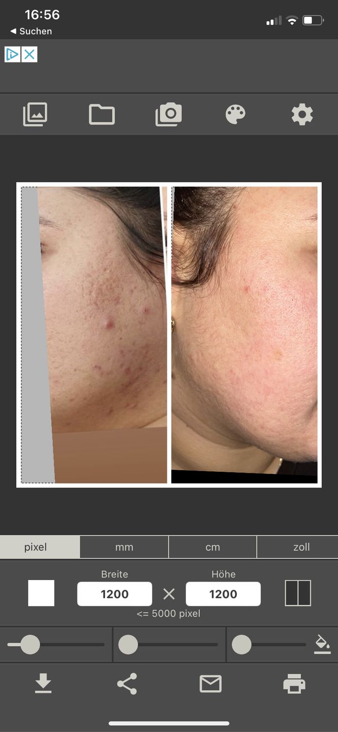 Customer photo review of Salicylsäure BHA 2% 50 ml