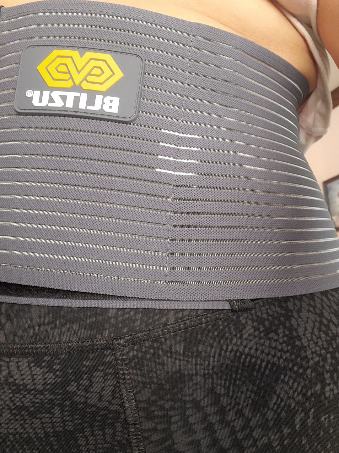 Customer photo review of Abdominal & Umbilical Hernia Belt with Pad for Men or Women