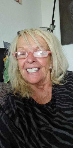 Customer photo review of Teeth-Veneer 2.0