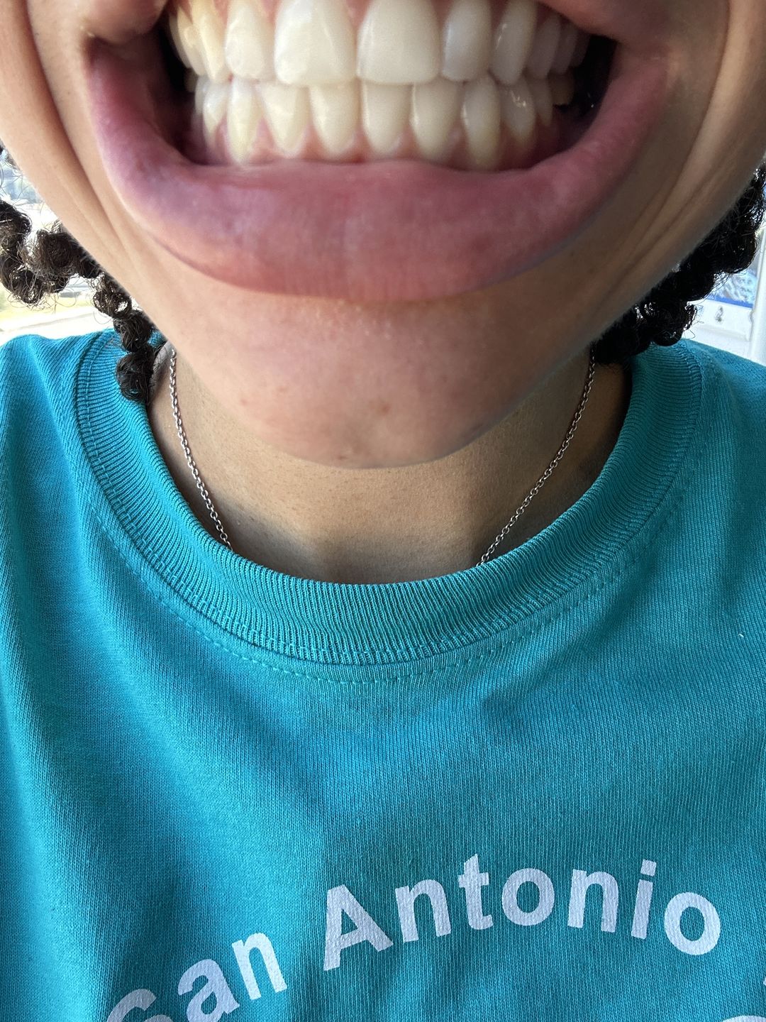Customer photo review of Big Mouth Sonic Toothbrush 2.0 (Special Edition)