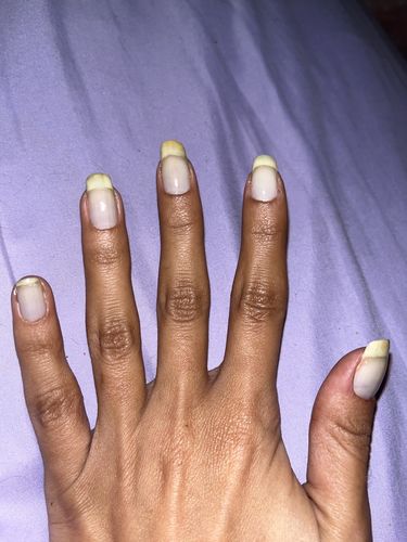 Customer photo review of Rocket Nail Fuel Nail Repair - Clear