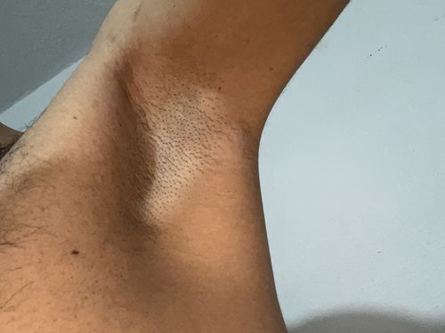 Customer photo review of ESENCIAL KIT - MyHUEVOS®