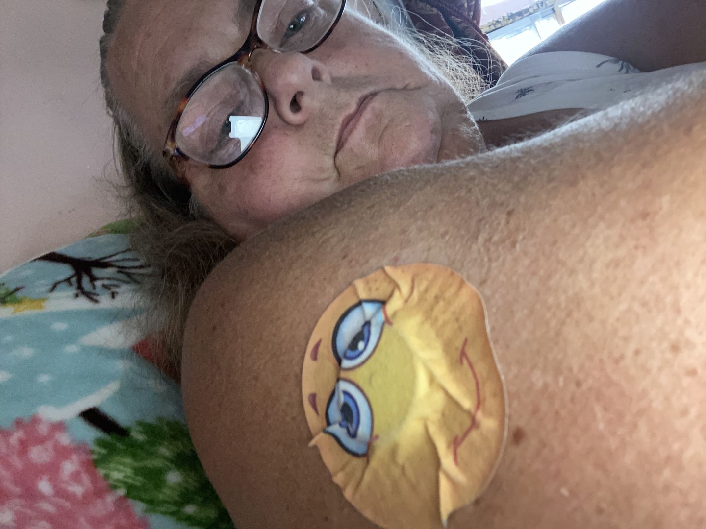 Customer photo review of Skin Grip Original - Freestyle Libre Adhesive Patches