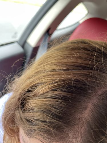 Customer photo review of Spray éclaircissant