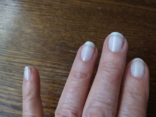 Customer photo review of The Nail Starter Kit