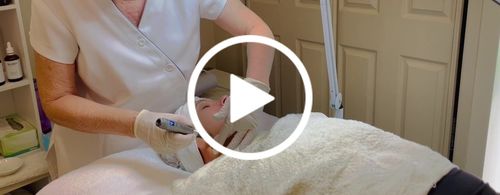 Customer video review of 11 Pin Replacement Cartridges for M8 PowerDerm 10X